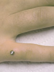 Hand-Piercing