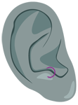 Anti-Tragus-Ohrpiercing