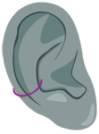 Conch-Ohrpiercing