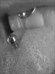 Sexy-Piercing an der Zunge
