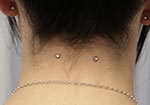 Piercing microdermal double nuque